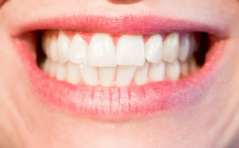 Aktualna technika używana w salonach stomatologii estetycznej zdoła spowodować, że odbierzemy śliczny uśmiech.